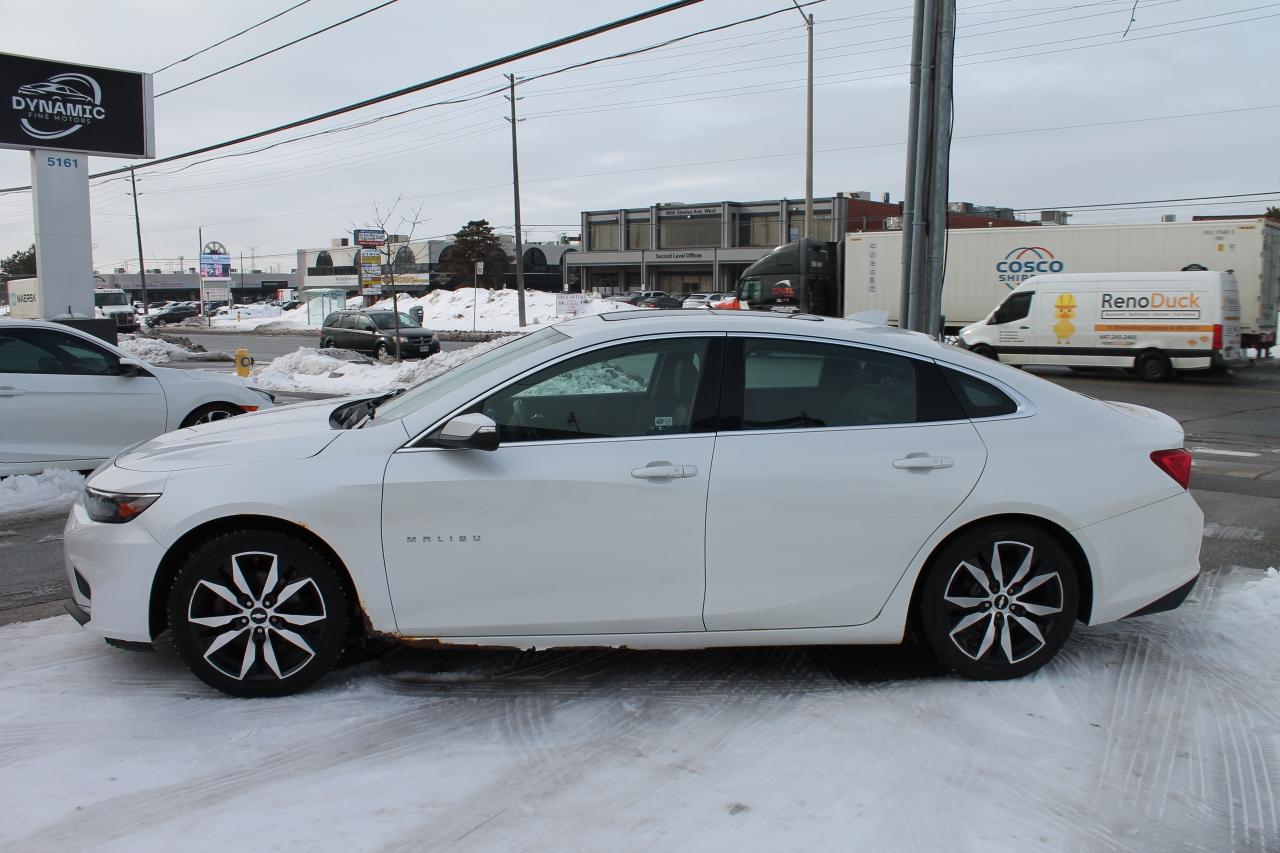 2016 Chevrolet Malibu 1LT Photo