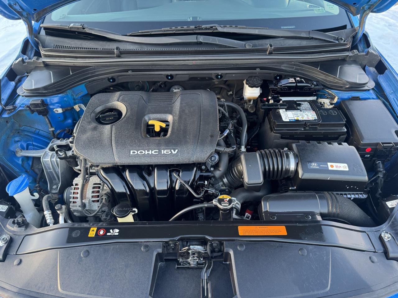 2018 Hyundai Elantra SEL Photo