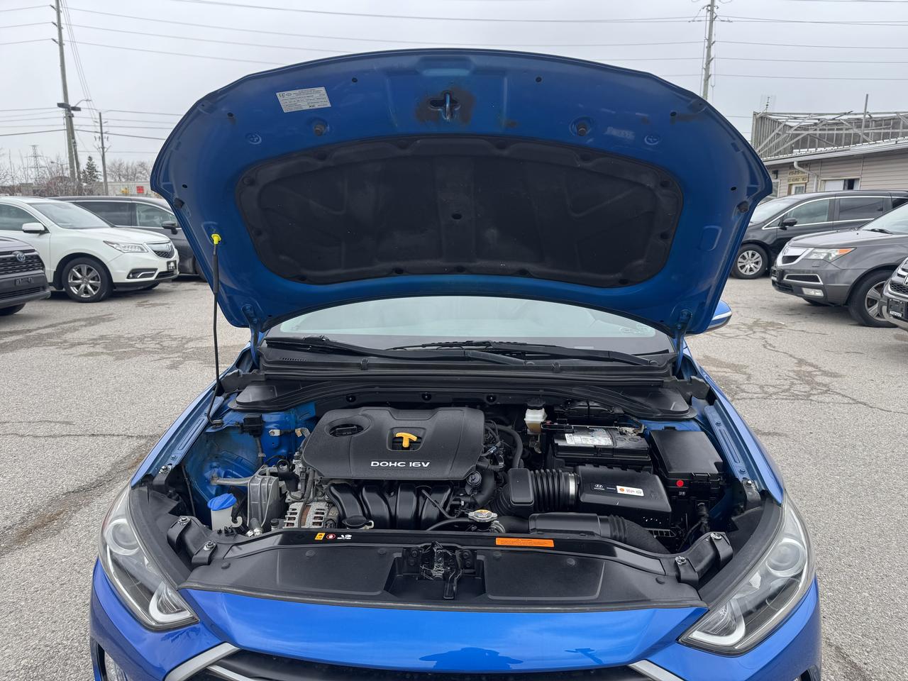 2018 Hyundai Elantra SEL Photo