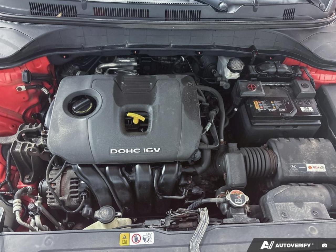 2018 Hyundai KONA  Photo