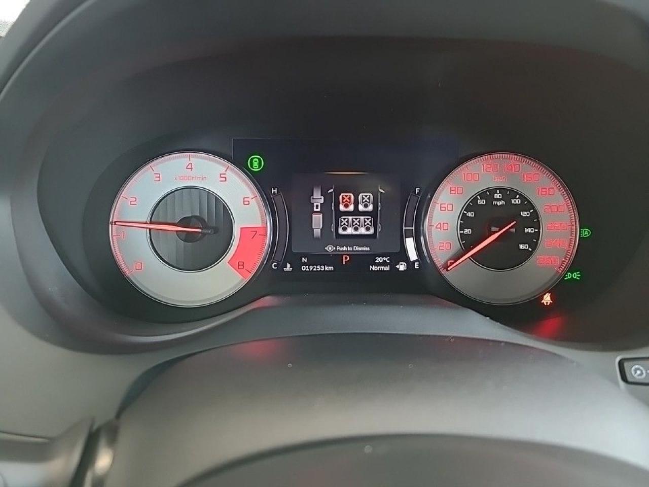 2024 Acura RDX A-Spec AWD (7 Year 160K Factory Warranty Incl) Photo