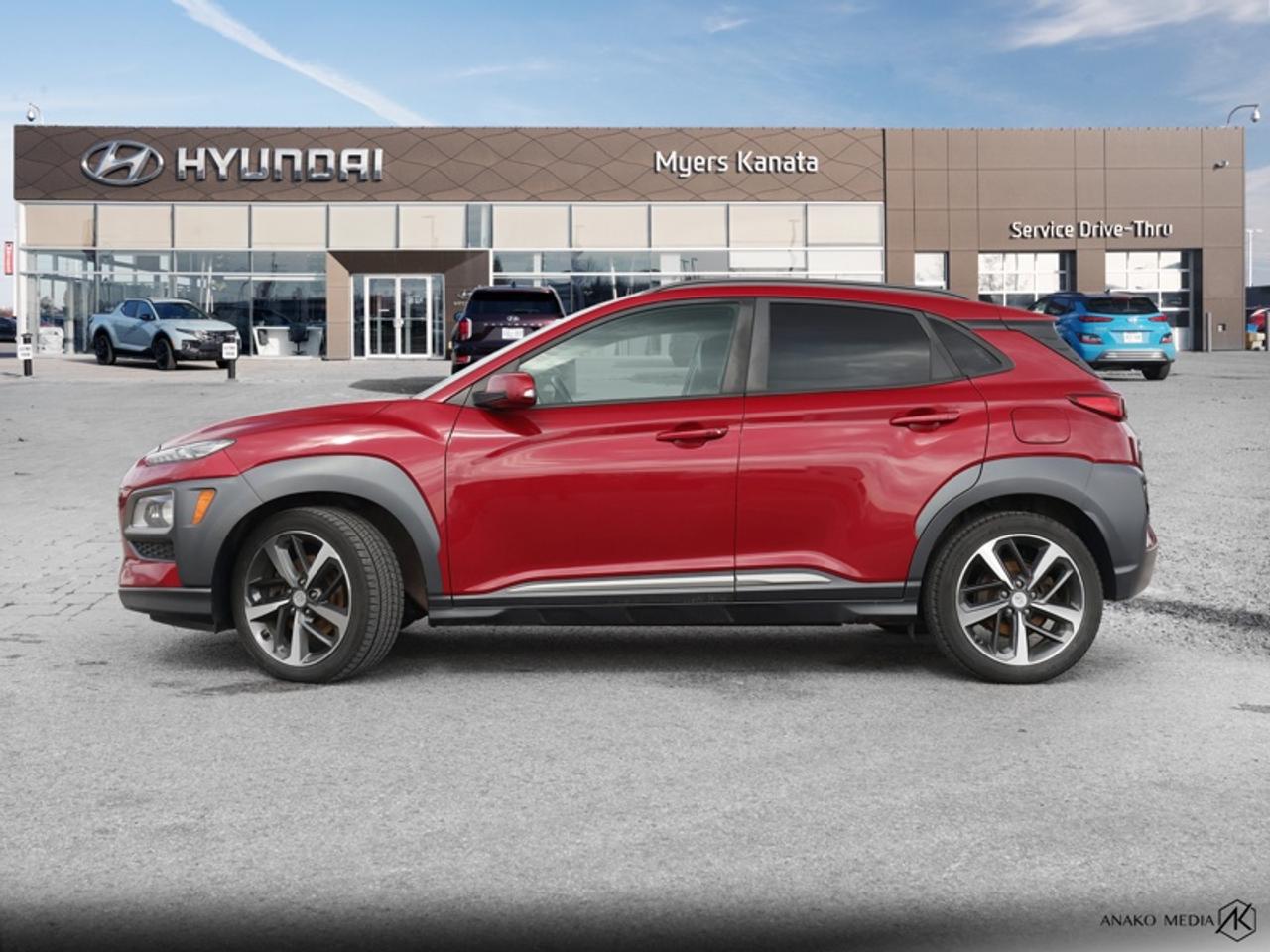 2018 Hyundai KONA 1.6T Ultimate  - $63.28 /Wk Photo4