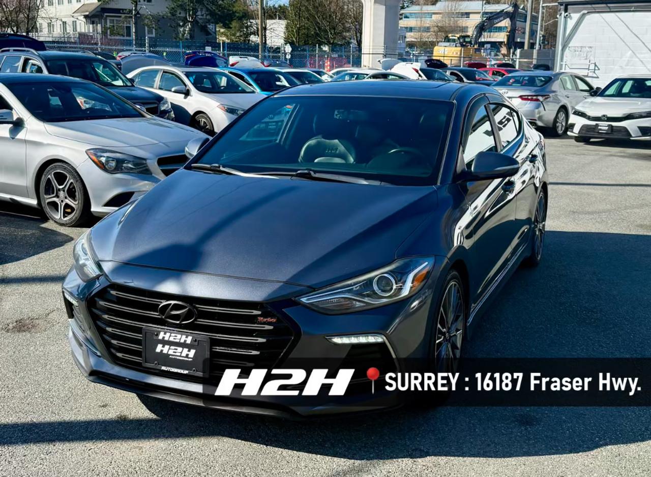 2017 Hyundai Elantra FINANCING AVAILABLE Photo1