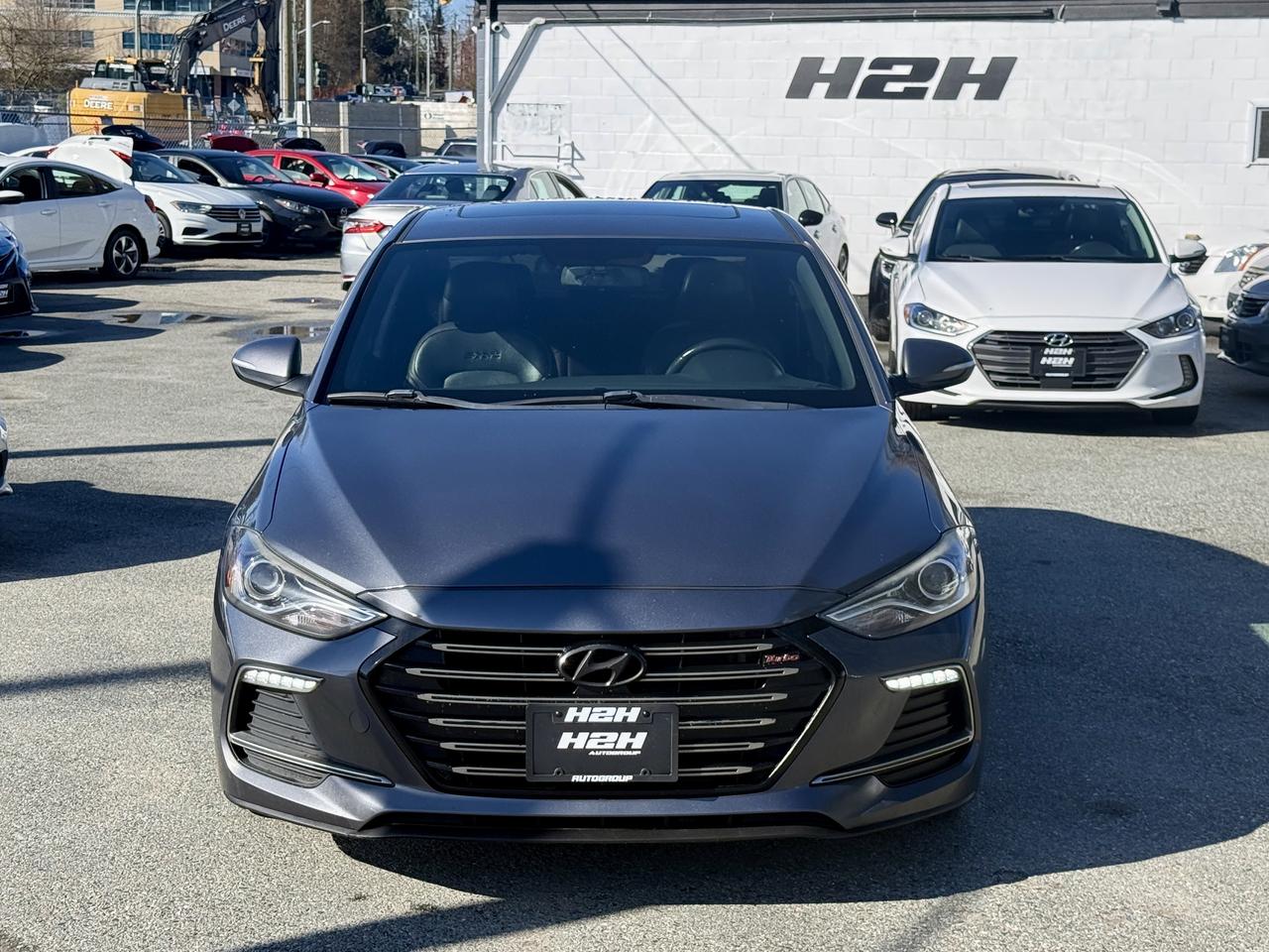 2017 Hyundai Elantra FINANCING AVAILABLE Photo2