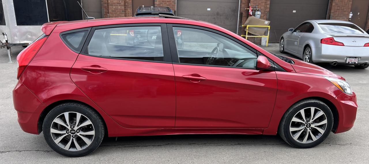 2017 Hyundai Accent SE Photo