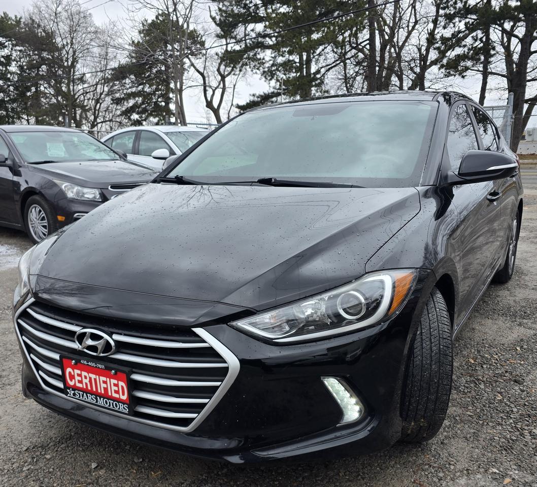 2017 Hyundai Elantra SE Photo