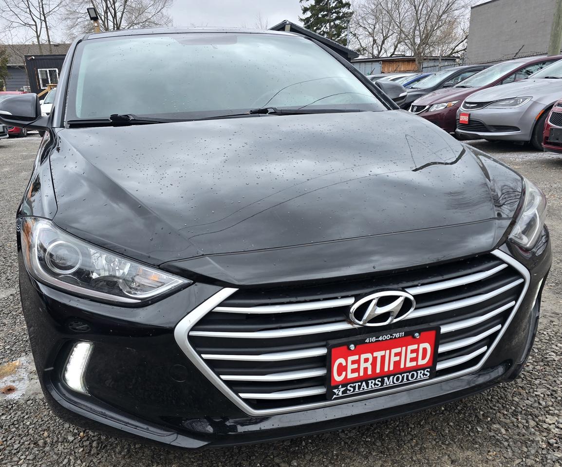 2017 Hyundai Elantra SE Photo