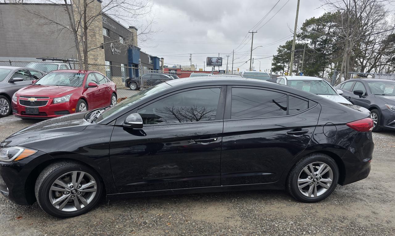 2017 Hyundai Elantra SE Photo