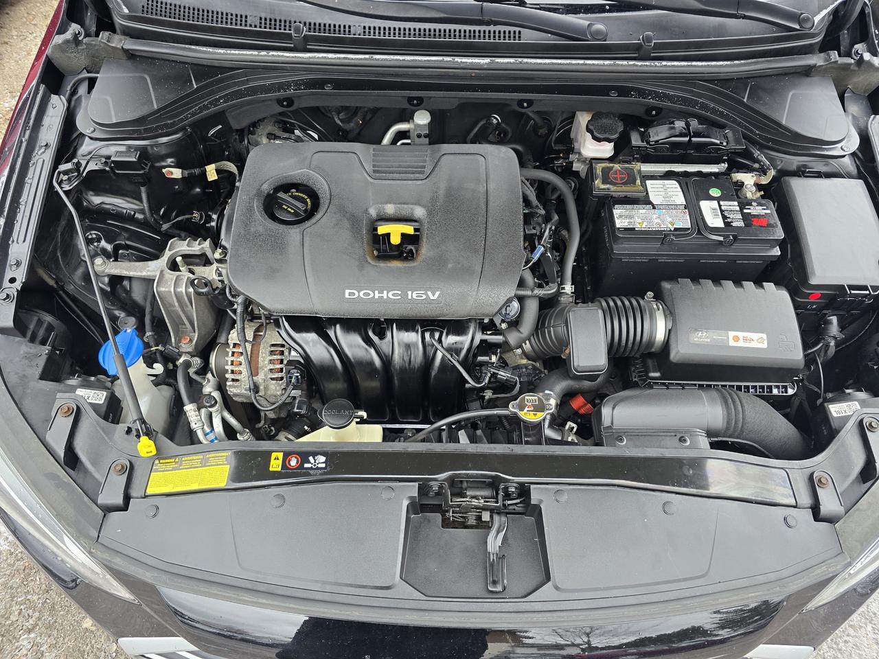 2017 Hyundai Elantra SE Photo