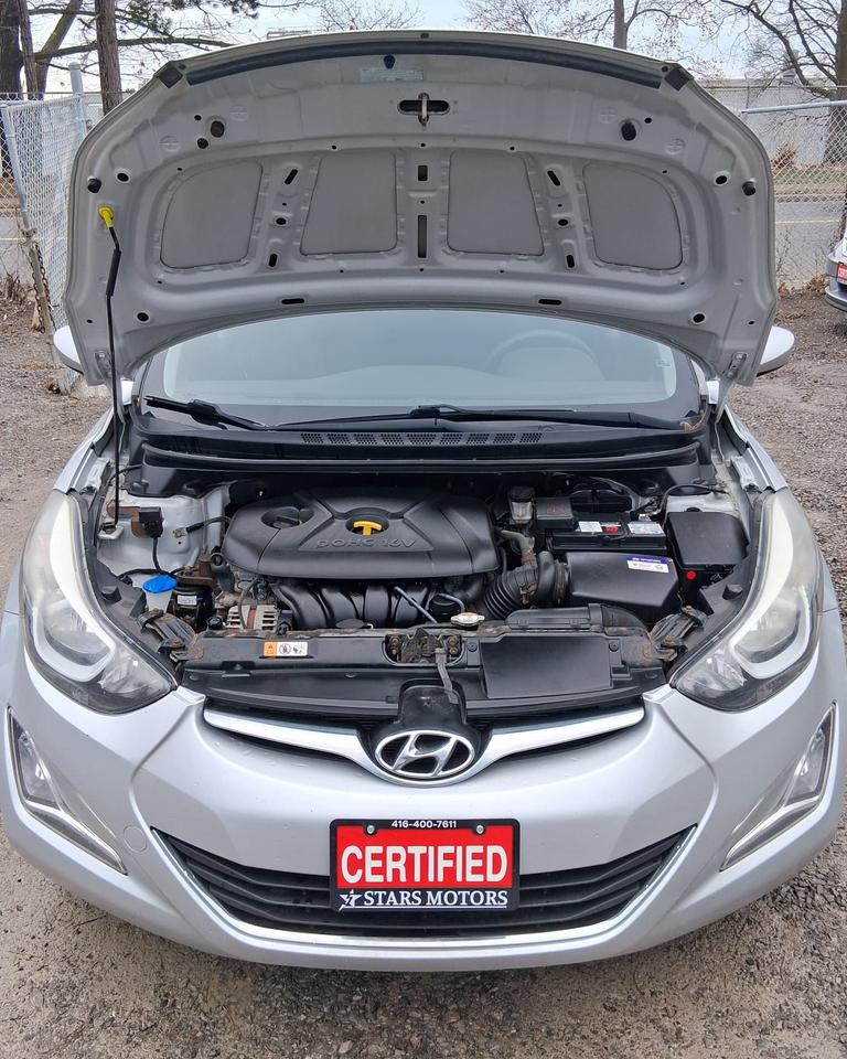 2015 Hyundai Elantra Limited Photo