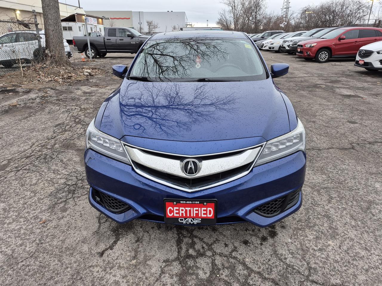 2017 Acura ILX  Photo
