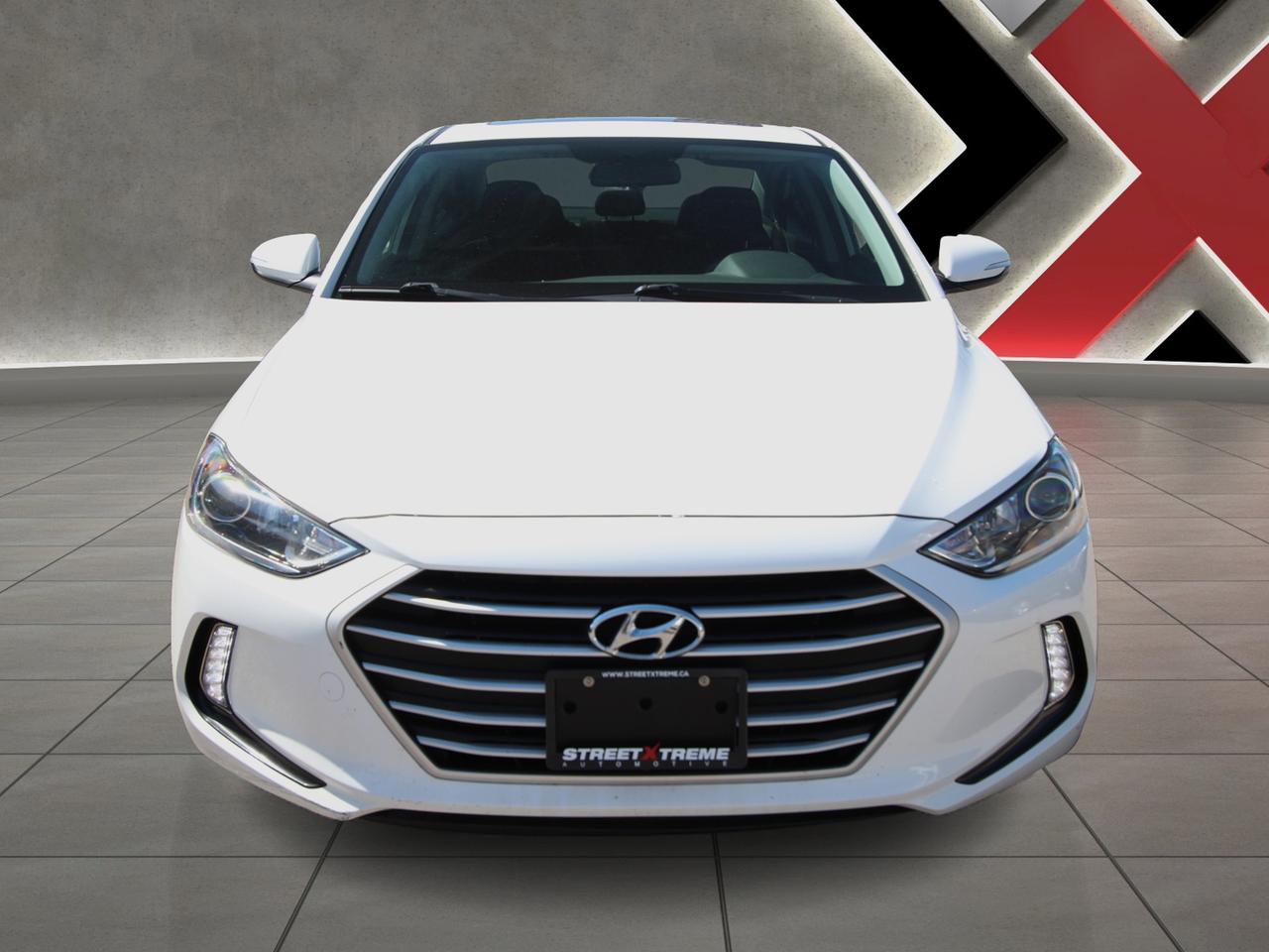 2018 Hyundai Elantra Limited - ACCIDENT FREE Photo