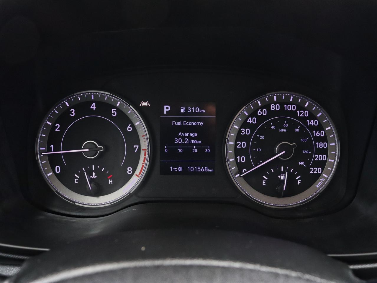 2022 Hyundai Venue Ultimate Photo