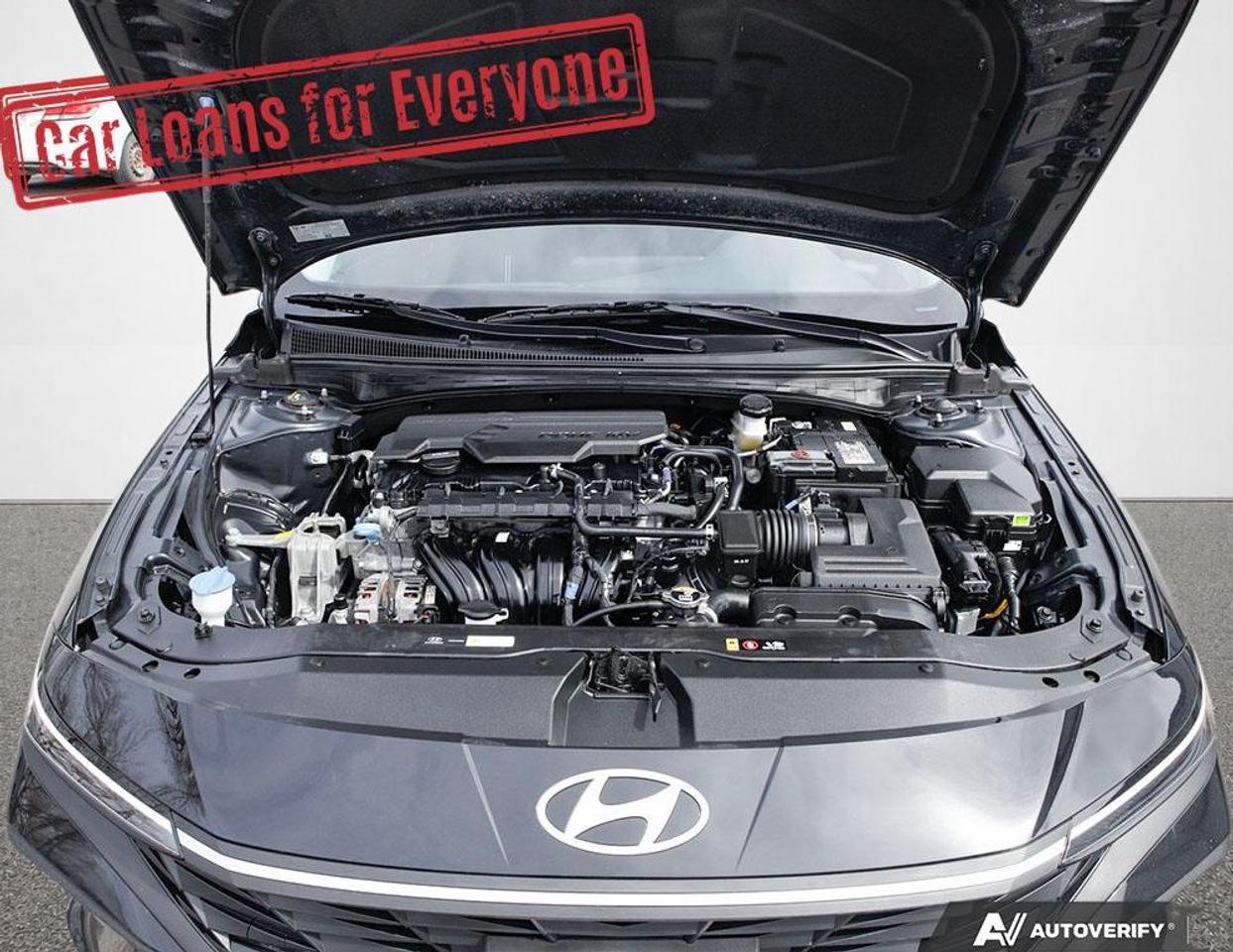 2025 Hyundai Elantra Preferred Photo