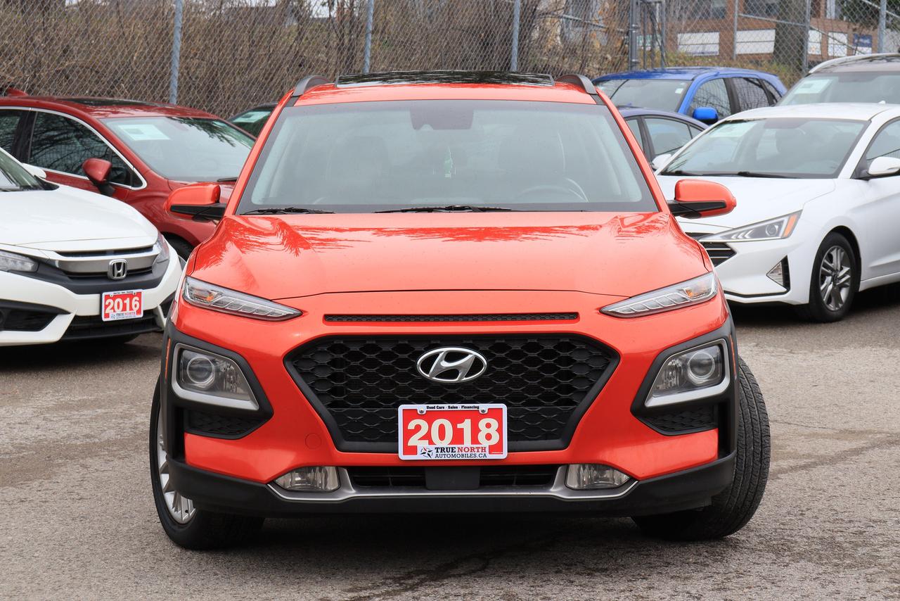 2018 Hyundai KONA Luxury | AWD | Leather | Roof | CarPlay | BSM | LA Photo
