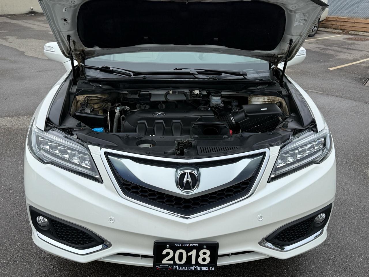 2018 Acura RDX Elite AWD  ACCIDENT FREE 1-OWNER CERTIFIED MINT Photo