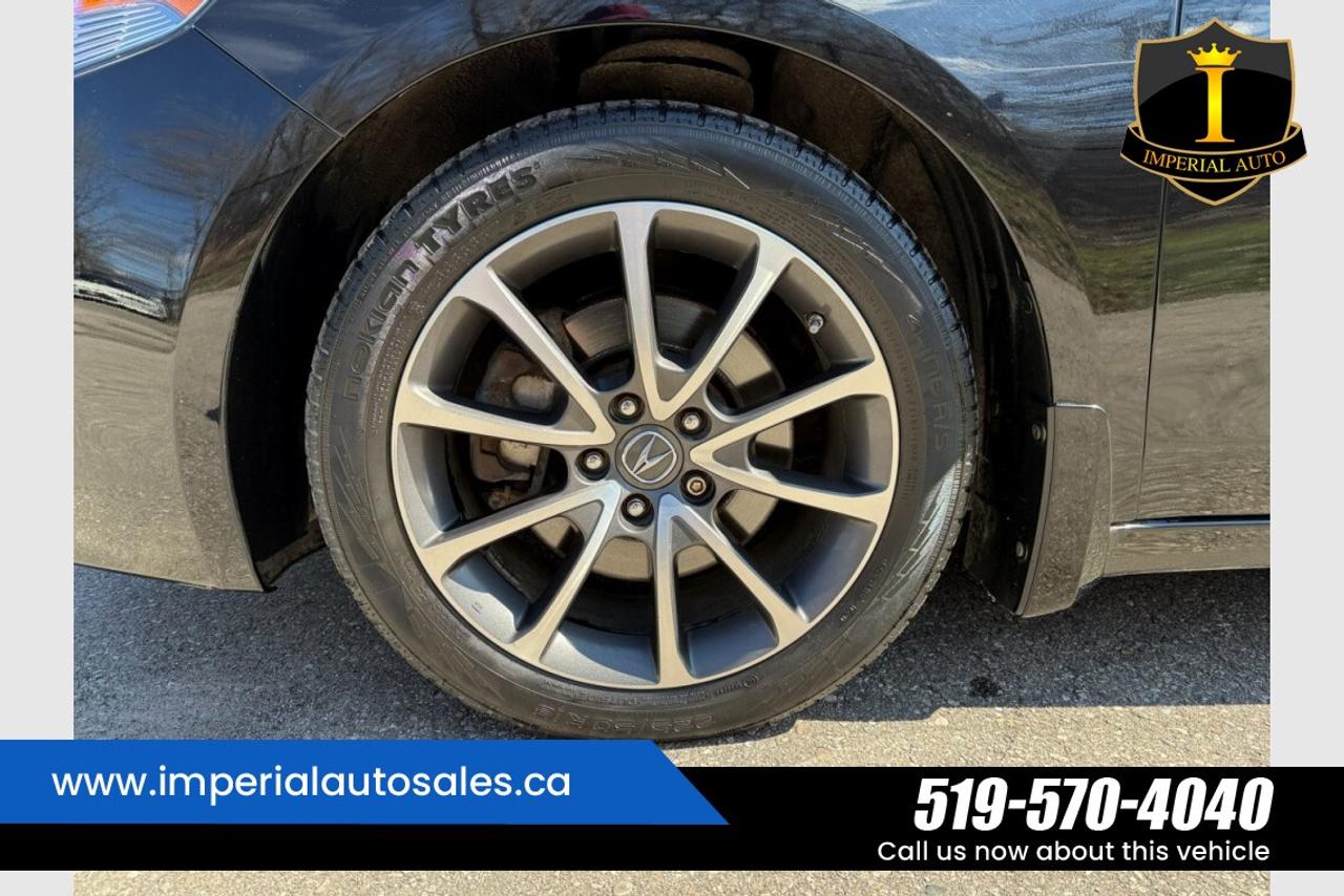 2015 Acura TLX TECH.PKG.FWD Photo