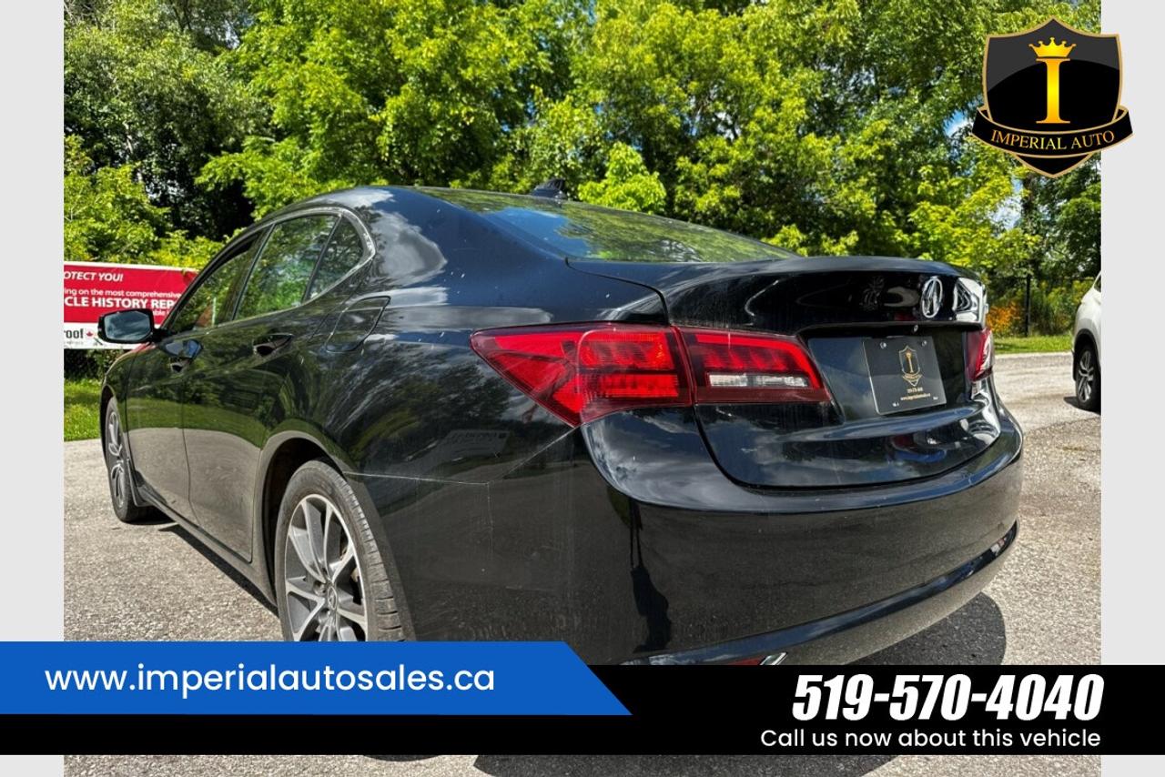 2015 Acura TLX Technology Photo