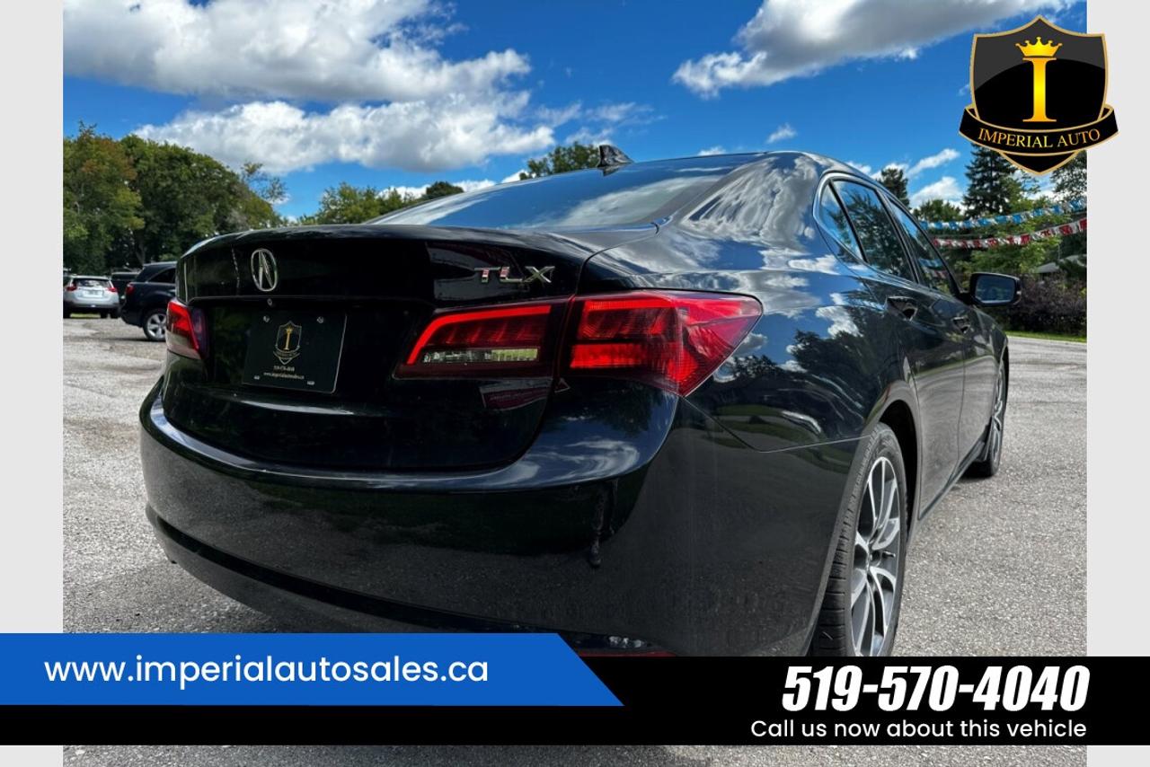2015 Acura TLX Technology Photo