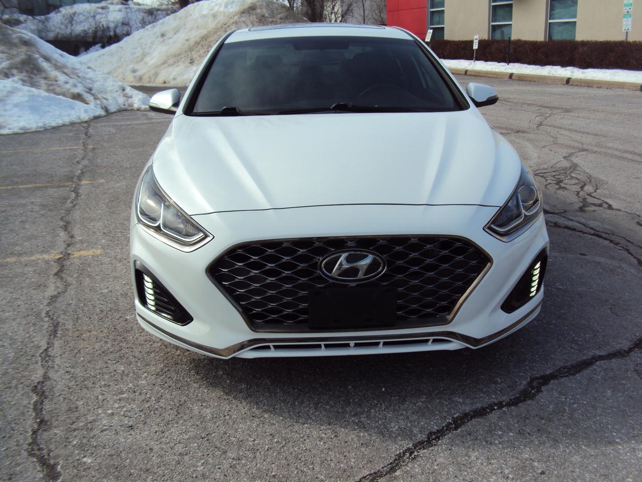2018 Hyundai Sonata SPORT Photo