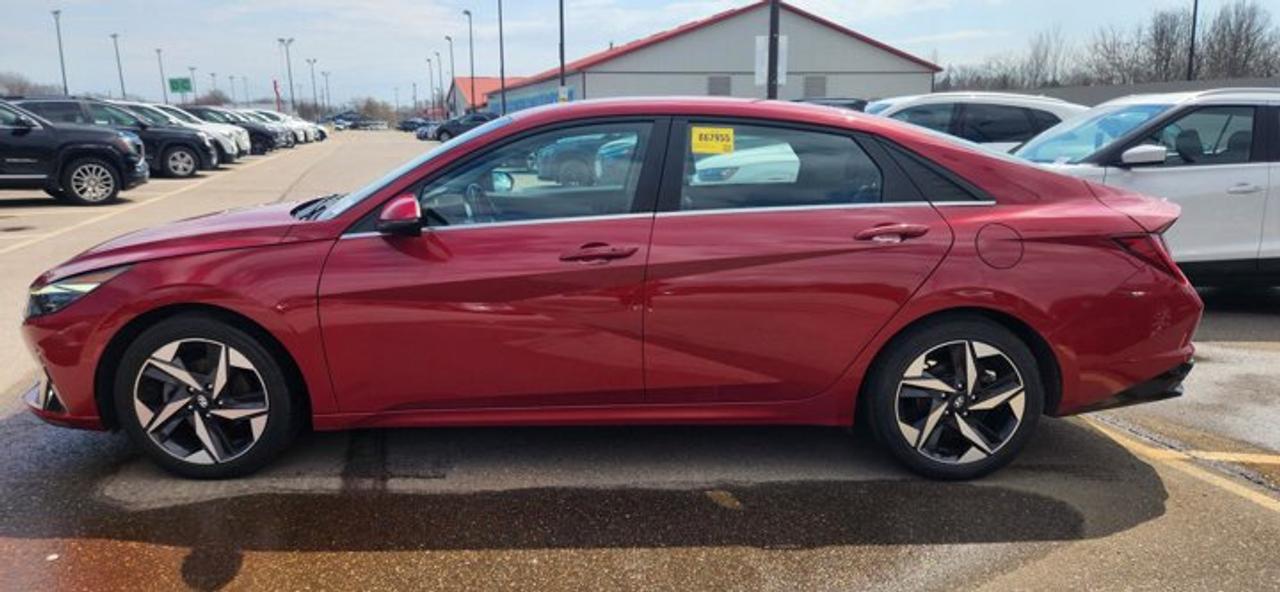 2022 Hyundai Elantra Ultimate | No Accidents | Leather Seats | Heated Steering Wheel Photo