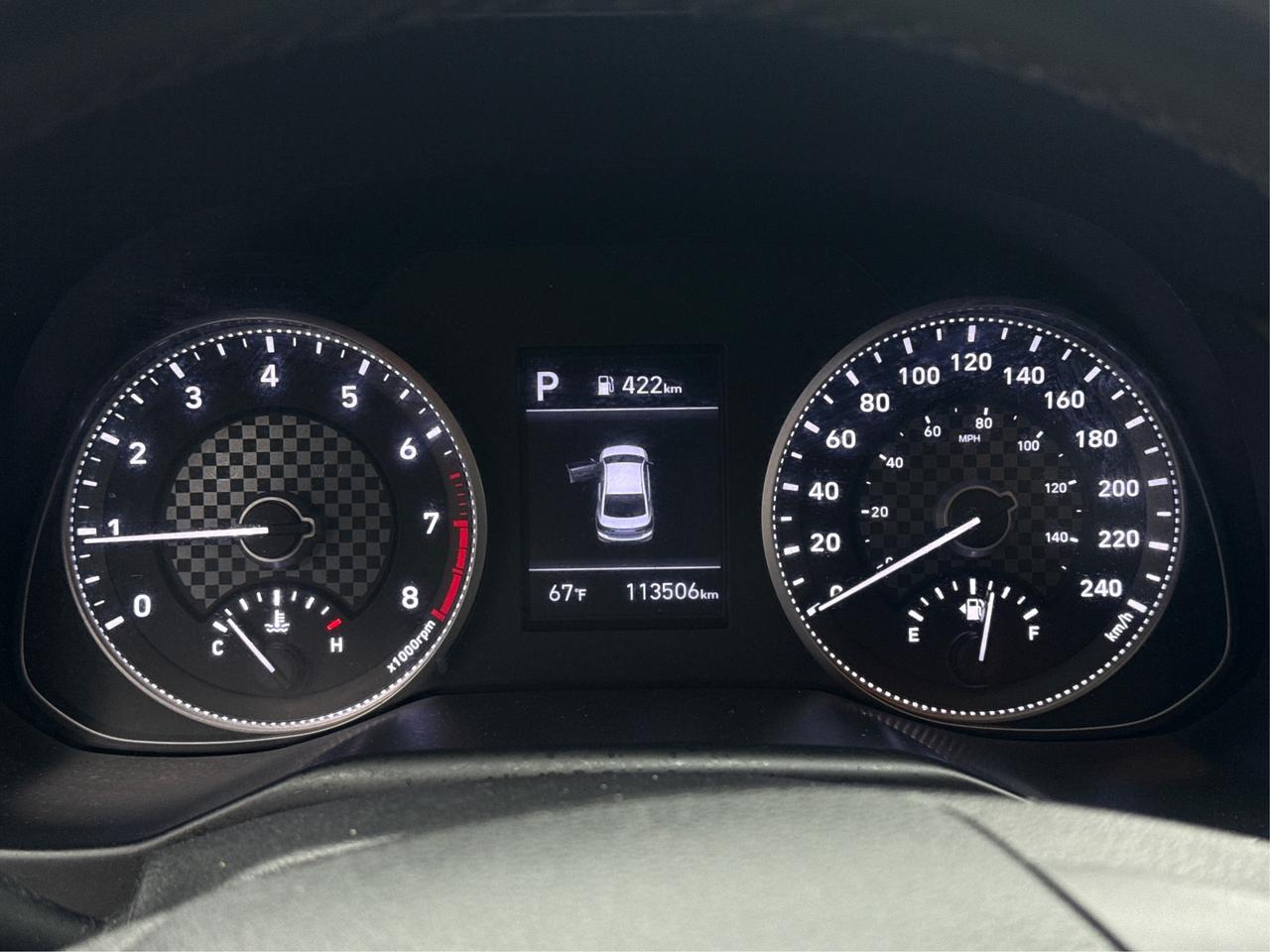 2020 Hyundai Elantra LEATHER SUNROOF PWR SEAT WE FINANCE ALL CREDIT! Photo