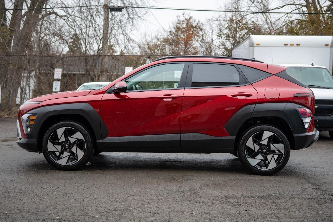 2025 Hyundai KONA 1.6T Preferred Sport AWD Photo