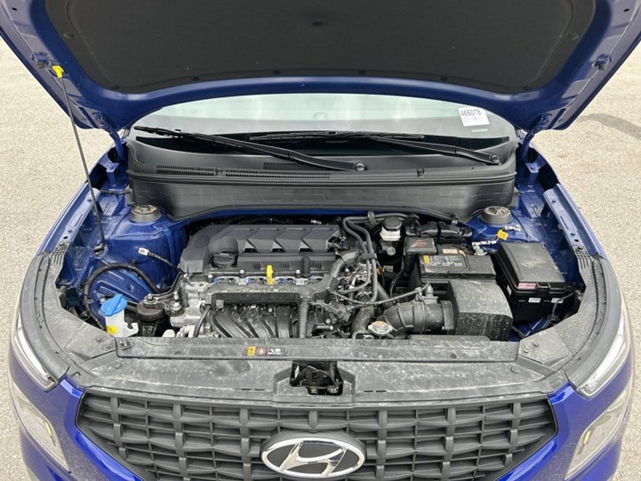 2026 Hyundai Venue Preferred | One Owner | No Accidents Photo