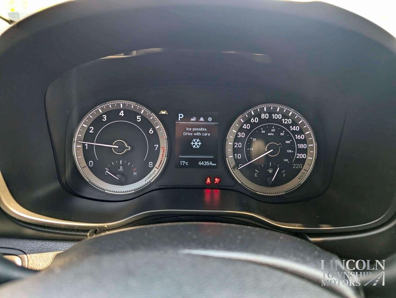 2022 Hyundai Venue Preferred- CLEAN CARFAX, RMT START, LOW KM & MORE! Photo