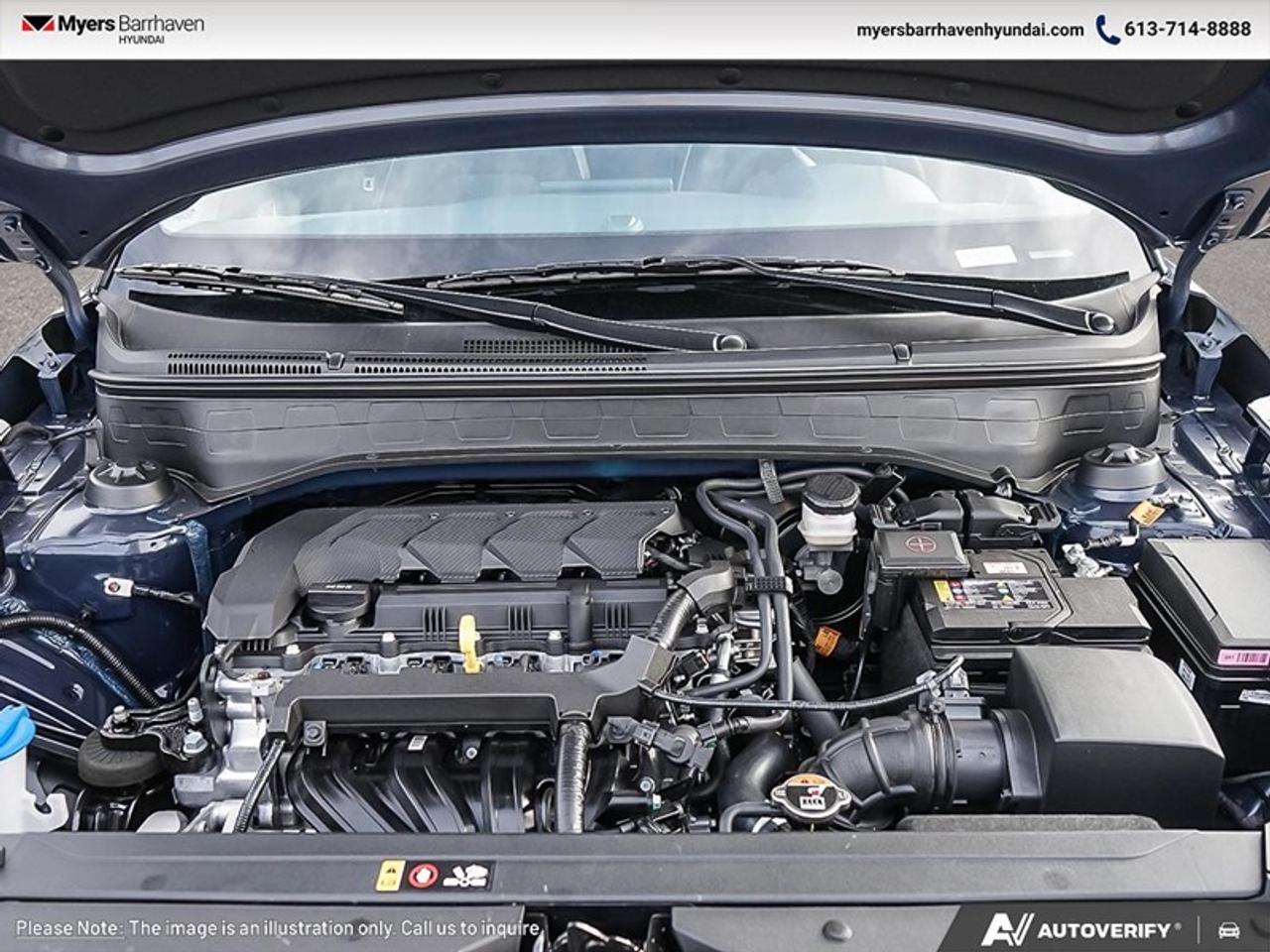 2026 Hyundai Venue Ultimate IVT  - Sunroof -  Heated Seats Photo