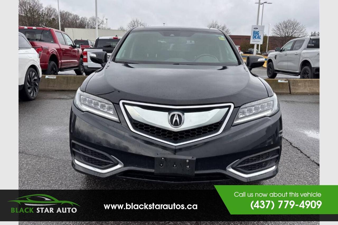 2018 Acura RDX  Photo2