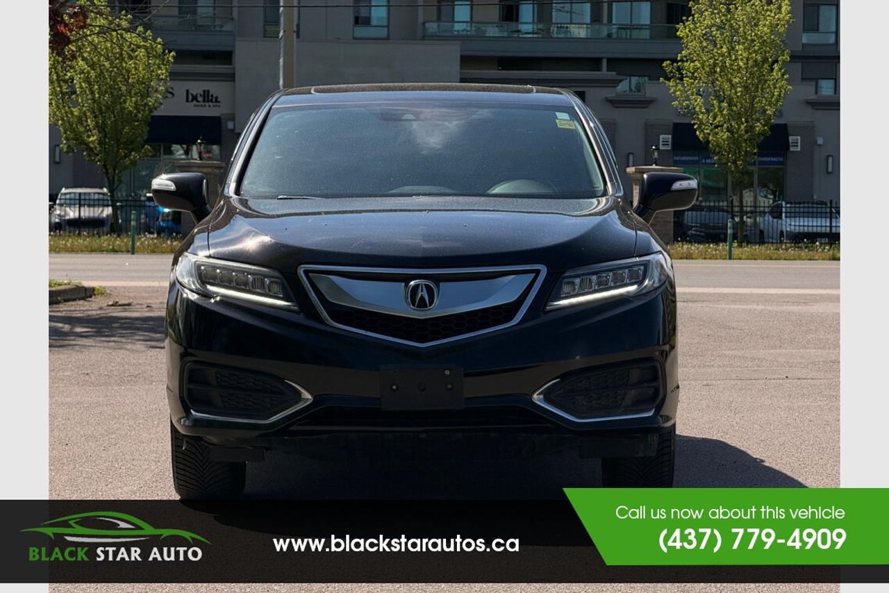 2018 Acura RDX  Photo