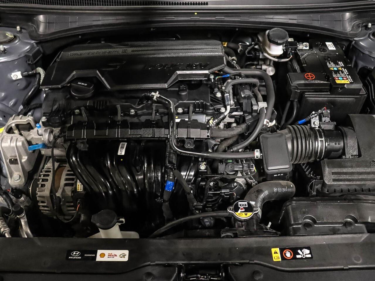 2025 Hyundai Elantra Preferred Photo