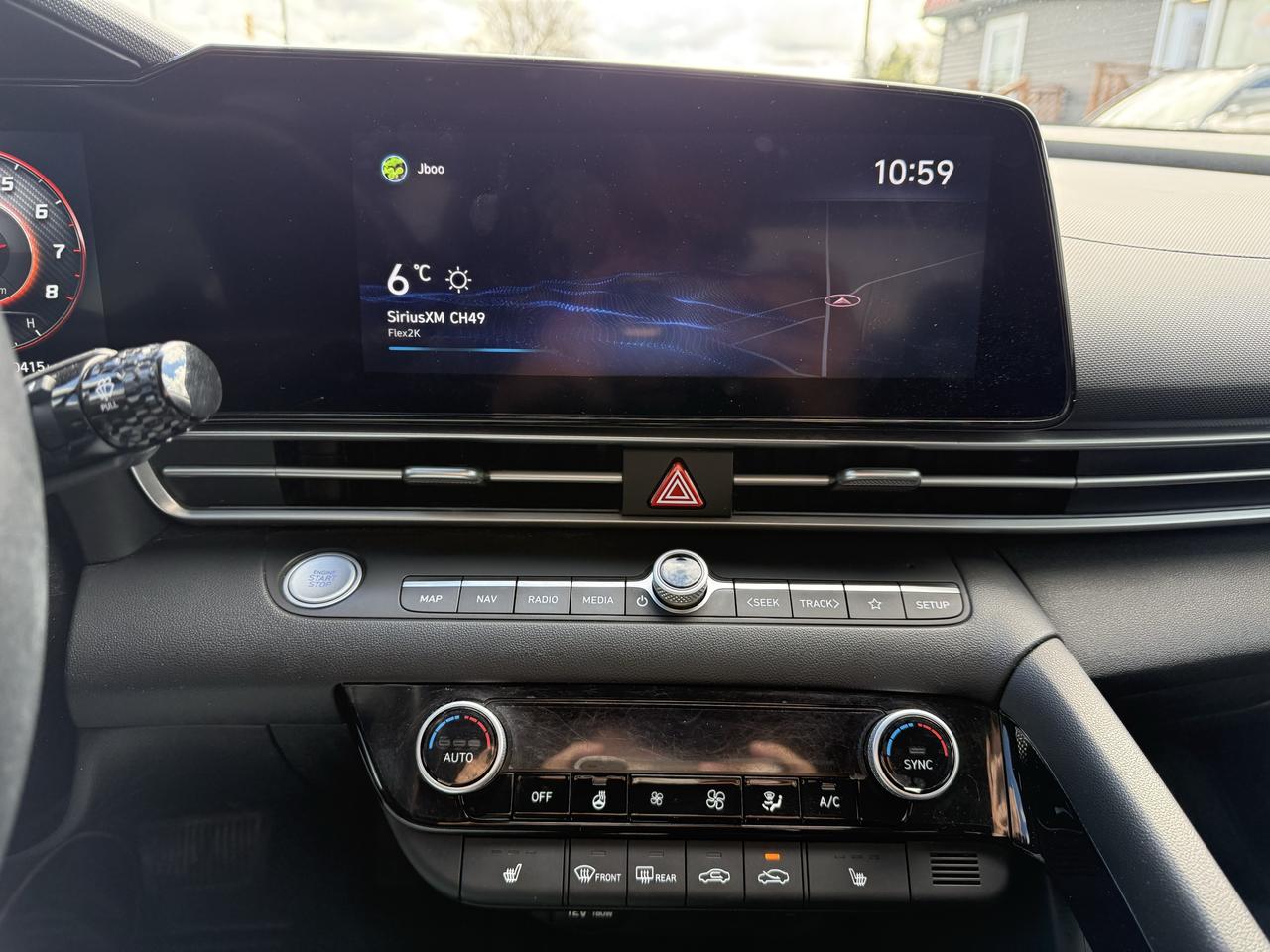 2021 Hyundai Elantra Ultimate Tech Photo