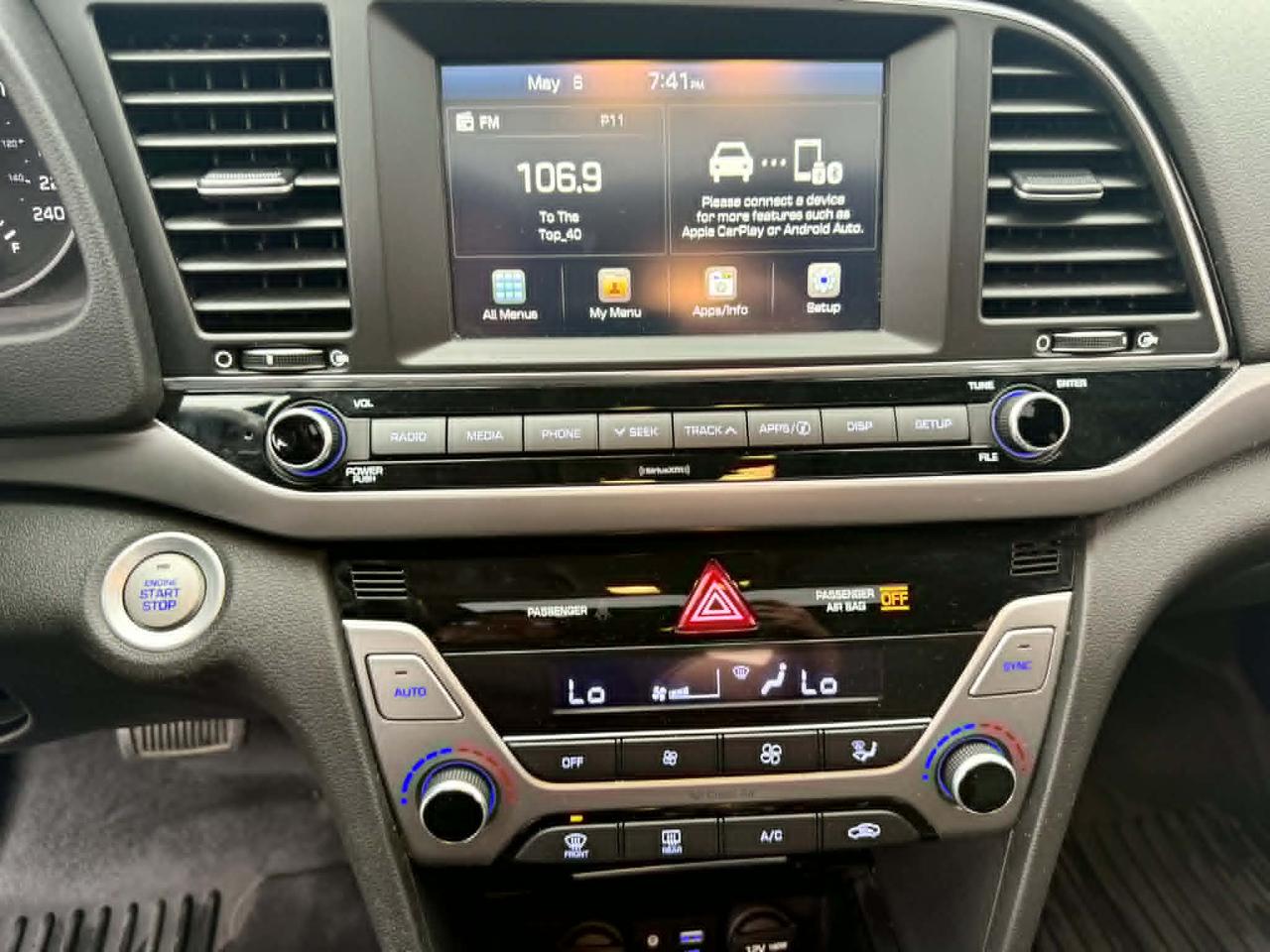 2017 Hyundai Elantra SE Photo