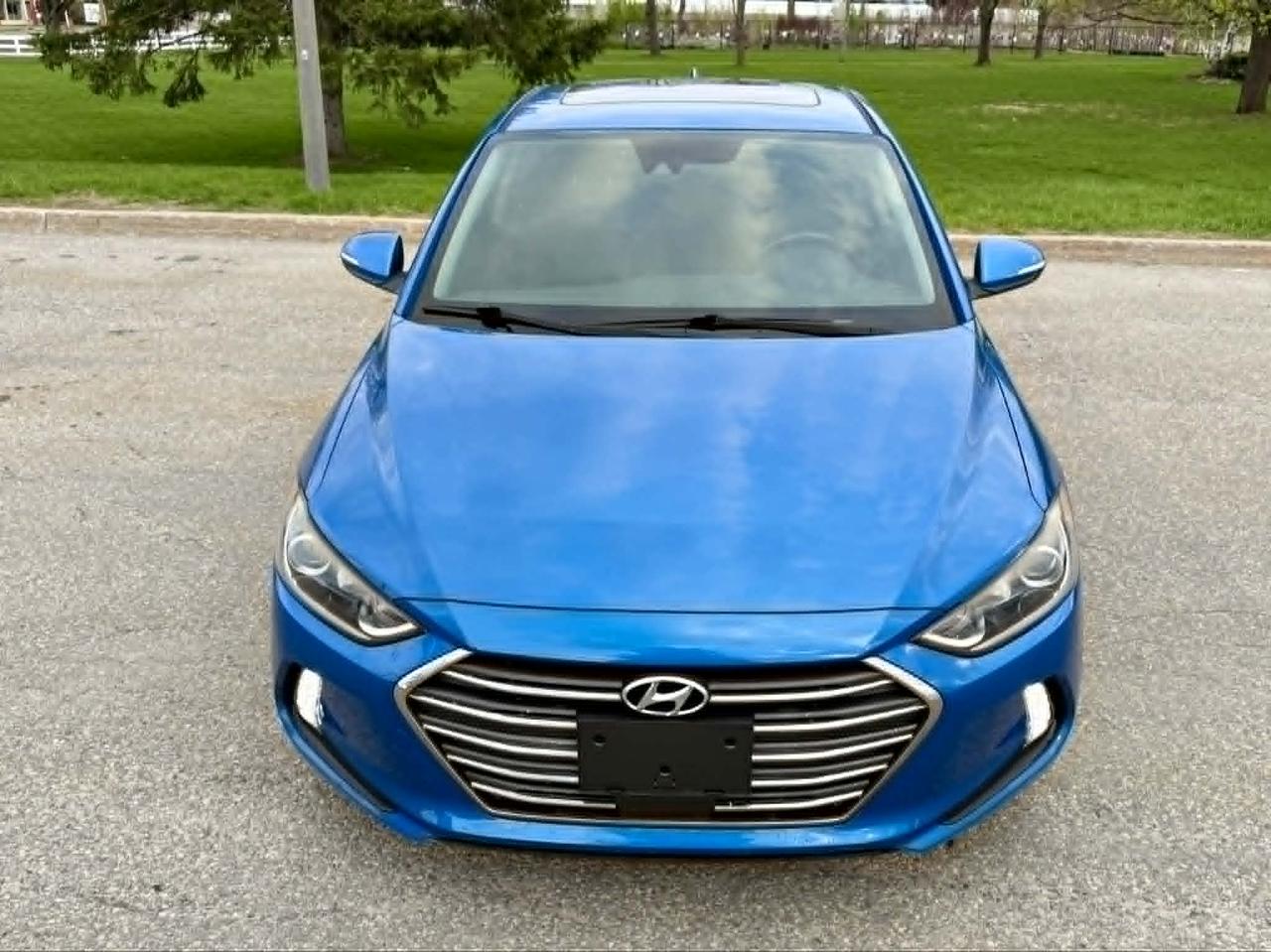 2017 Hyundai Elantra SE Photo3