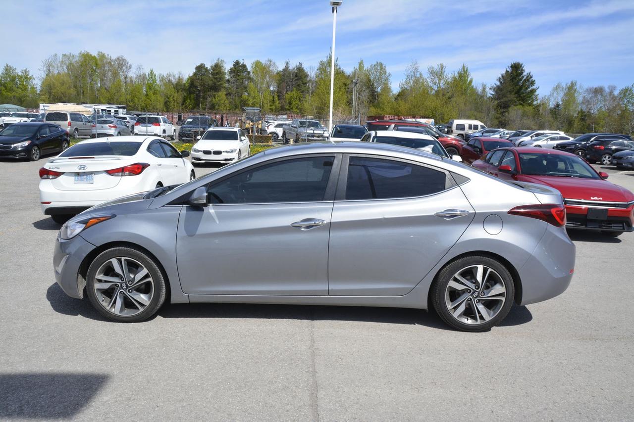 2015 Hyundai Elantra Limited Photo