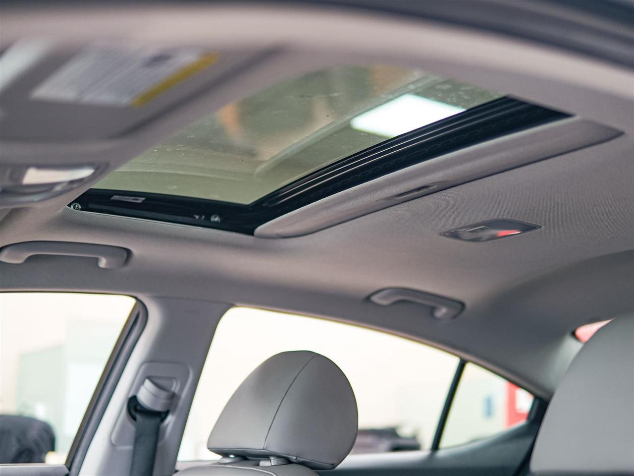 2020 Hyundai Elantra LUXURY | NO ACCIDENTS | LEATHER | SUNROOF Photo