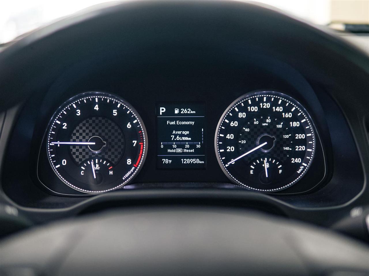 2020 Hyundai Elantra LUXURY | NO ACCIDENTS | LEATHER | SUNROOF Photo