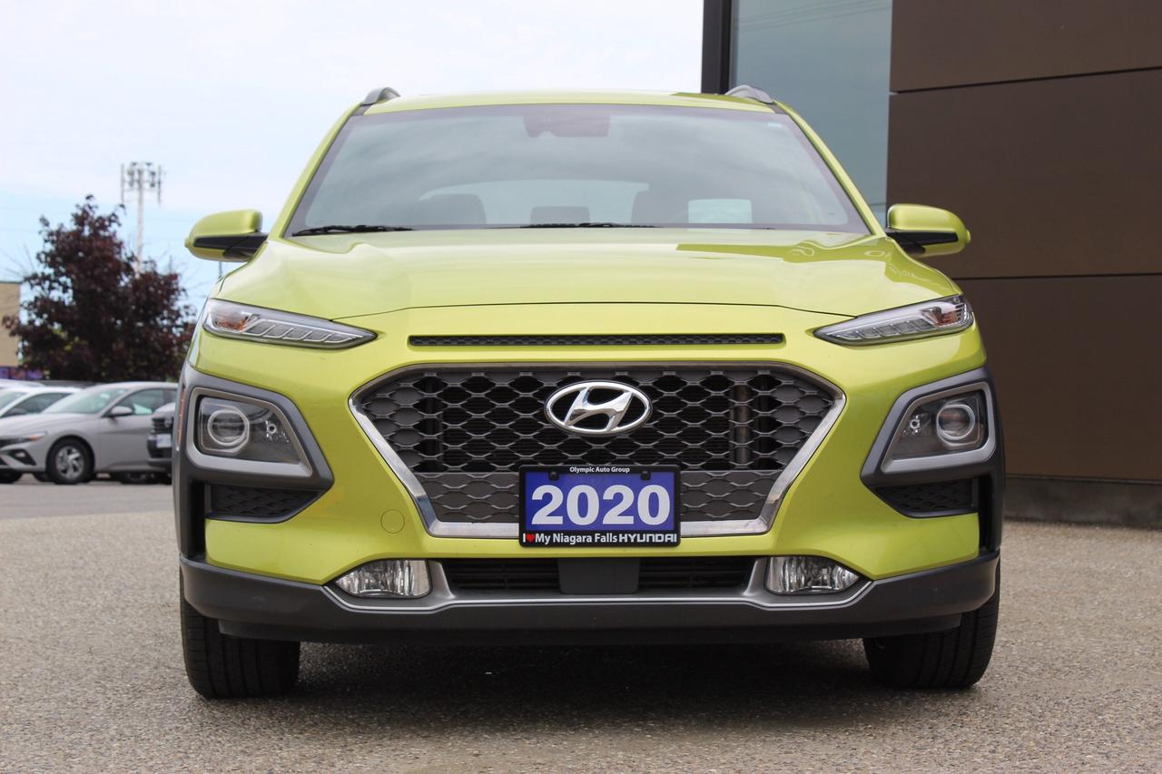2020 Hyundai KONA 1.6T Ultimate AWD w/Lime Colour Pack Photo