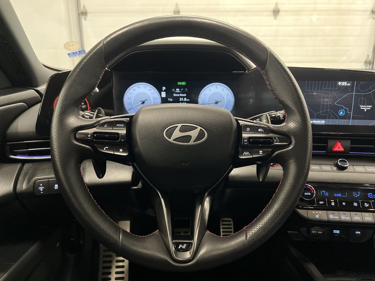 2025 Hyundai Elantra N LINE ULTIMATE | 200HP TURBO | LEATHER | SUNROOF Photo