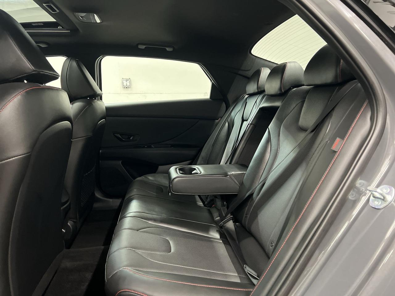 2025 Hyundai Elantra N LINE ULTIMATE | 200HP TURBO | LEATHER | SUNROOF Photo