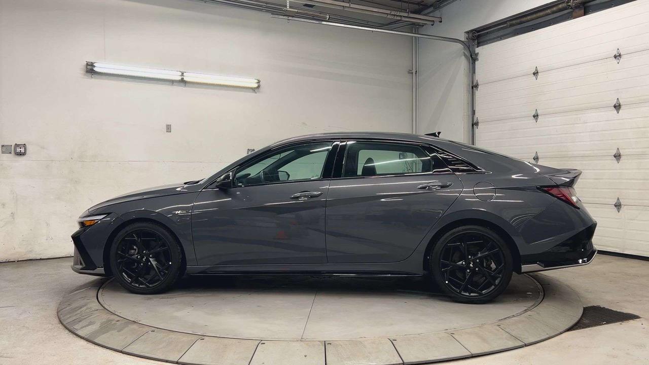 2025 Hyundai Elantra N LINE ULTIMATE | 200HP TURBO | LEATHER | SUNROOF Photo
