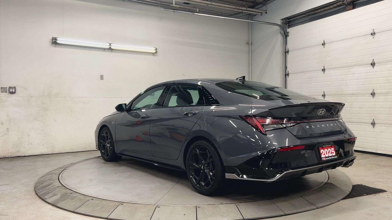 2025 Hyundai Elantra N LINE ULTIMATE | 200HP TURBO | LEATHER | SUNROOF Photo