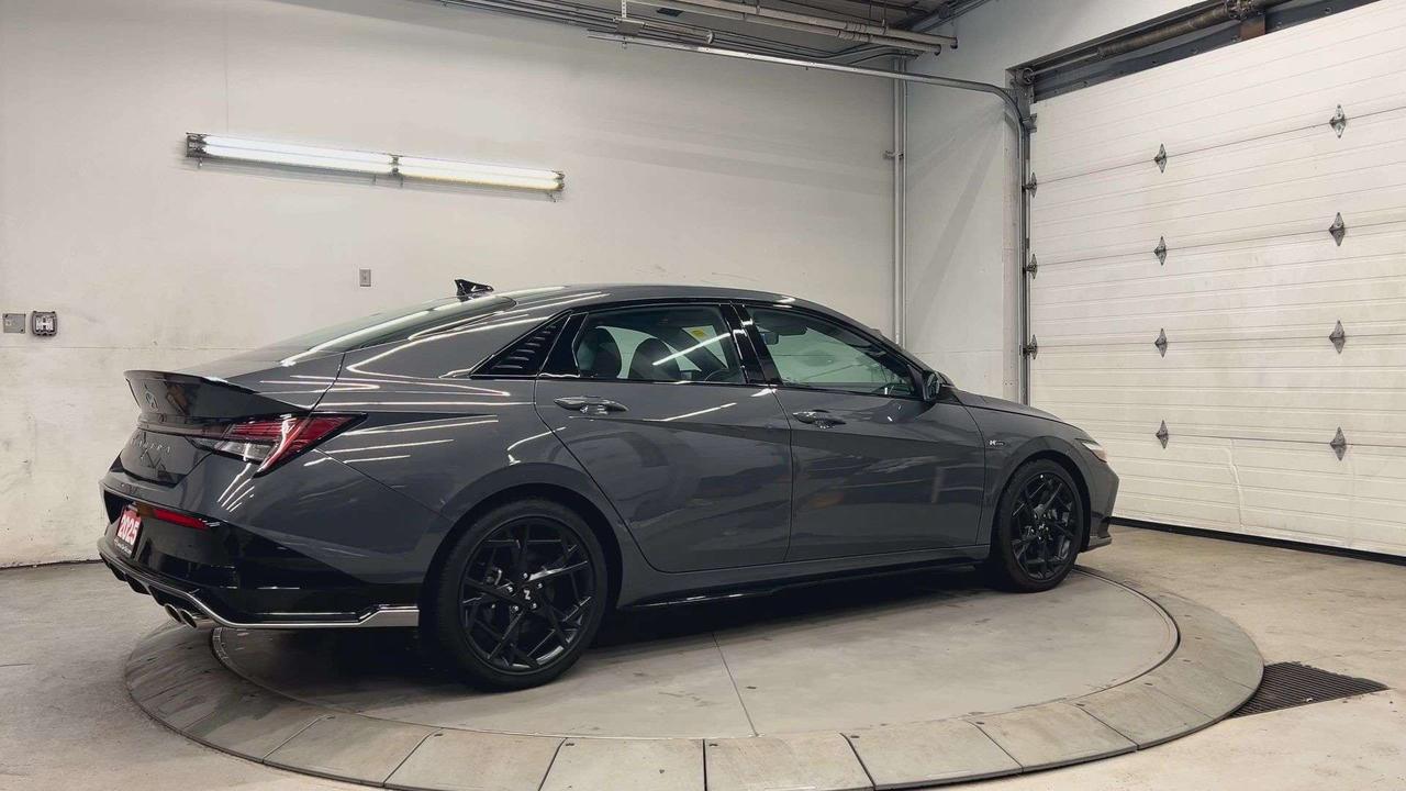 2025 Hyundai Elantra N LINE ULTIMATE | 200HP TURBO | LEATHER | SUNROOF Photo