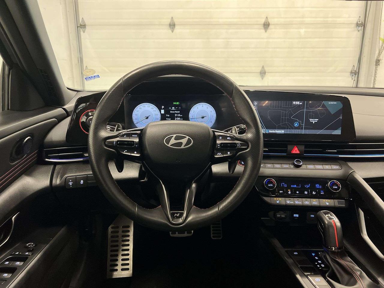 2025 Hyundai Elantra N LINE ULTIMATE | 200HP TURBO | LEATHER | SUNROOF Photo
