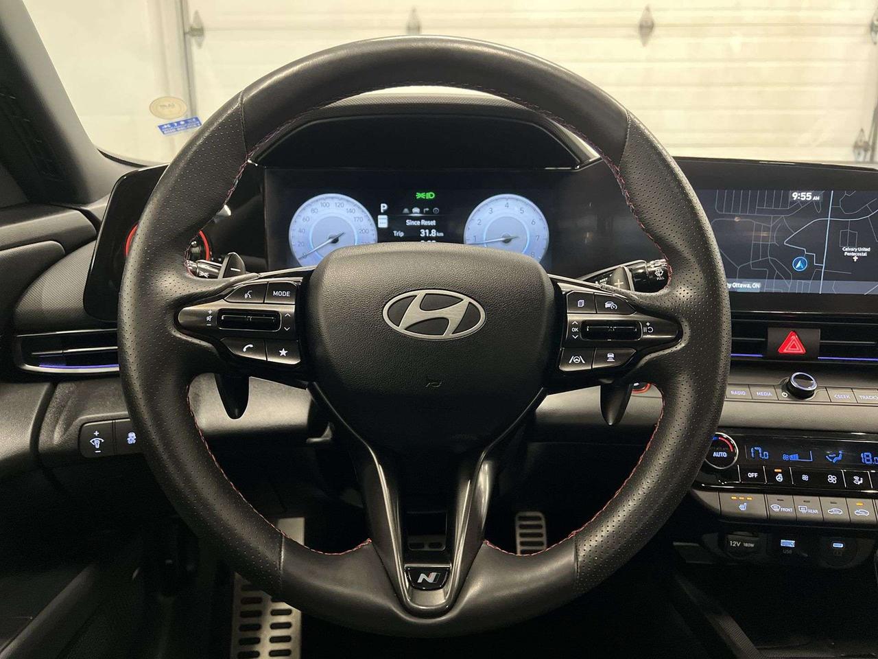 2025 Hyundai Elantra N LINE ULTIMATE | 200HP TURBO | LEATHER | SUNROOF Photo