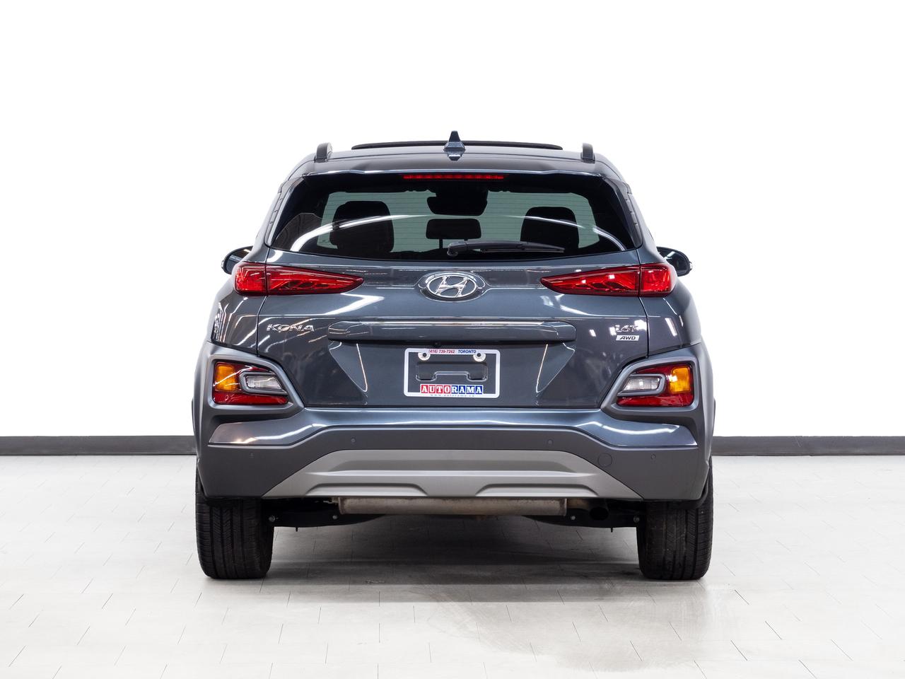 2021 Hyundai KONA ULTIMATE | AWD | Nav | Leather | Sunroof | CarPlay