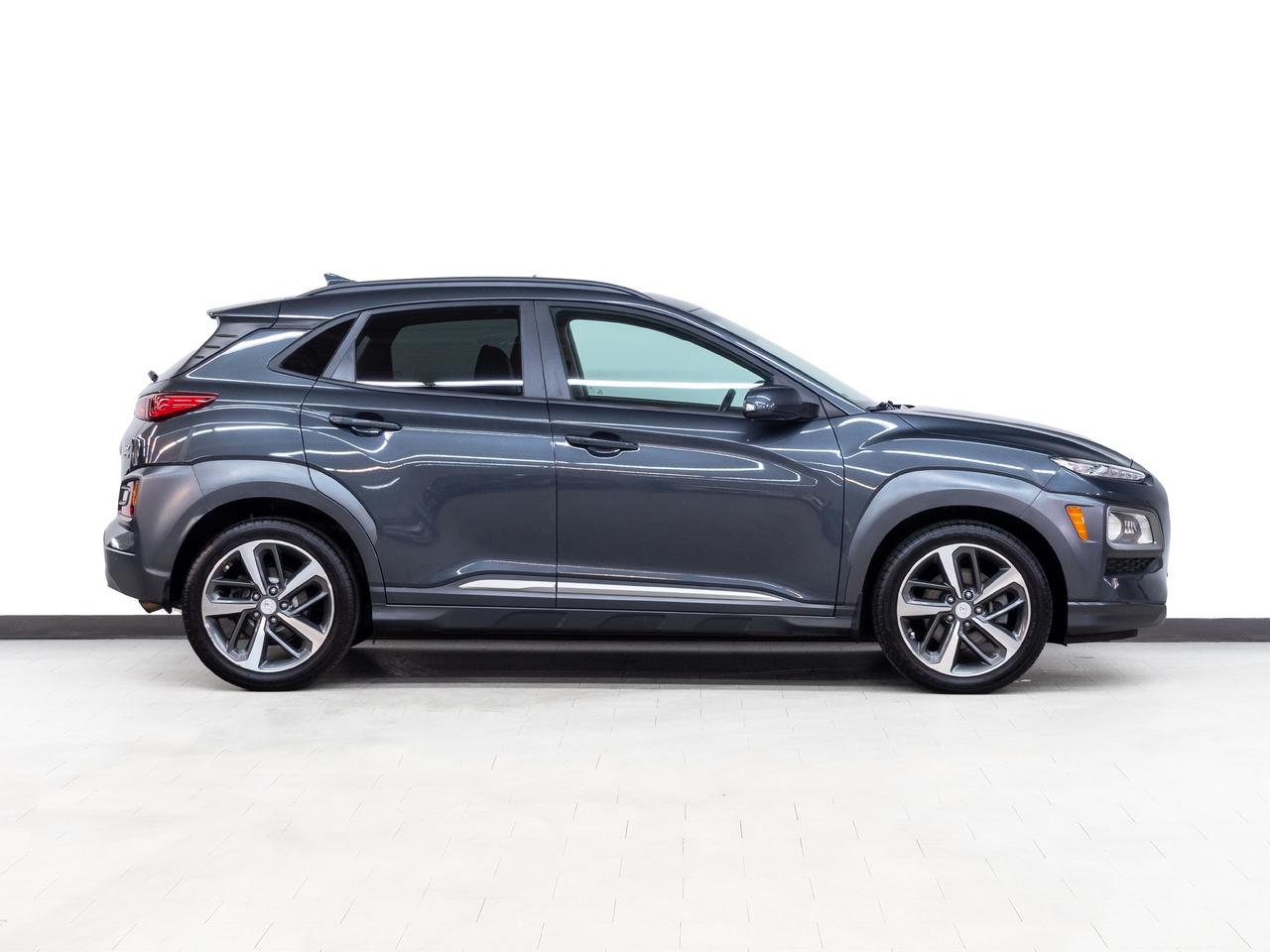 2021 Hyundai KONA ULTIMATE | AWD | Nav | Leather | Sunroof | CarPlay