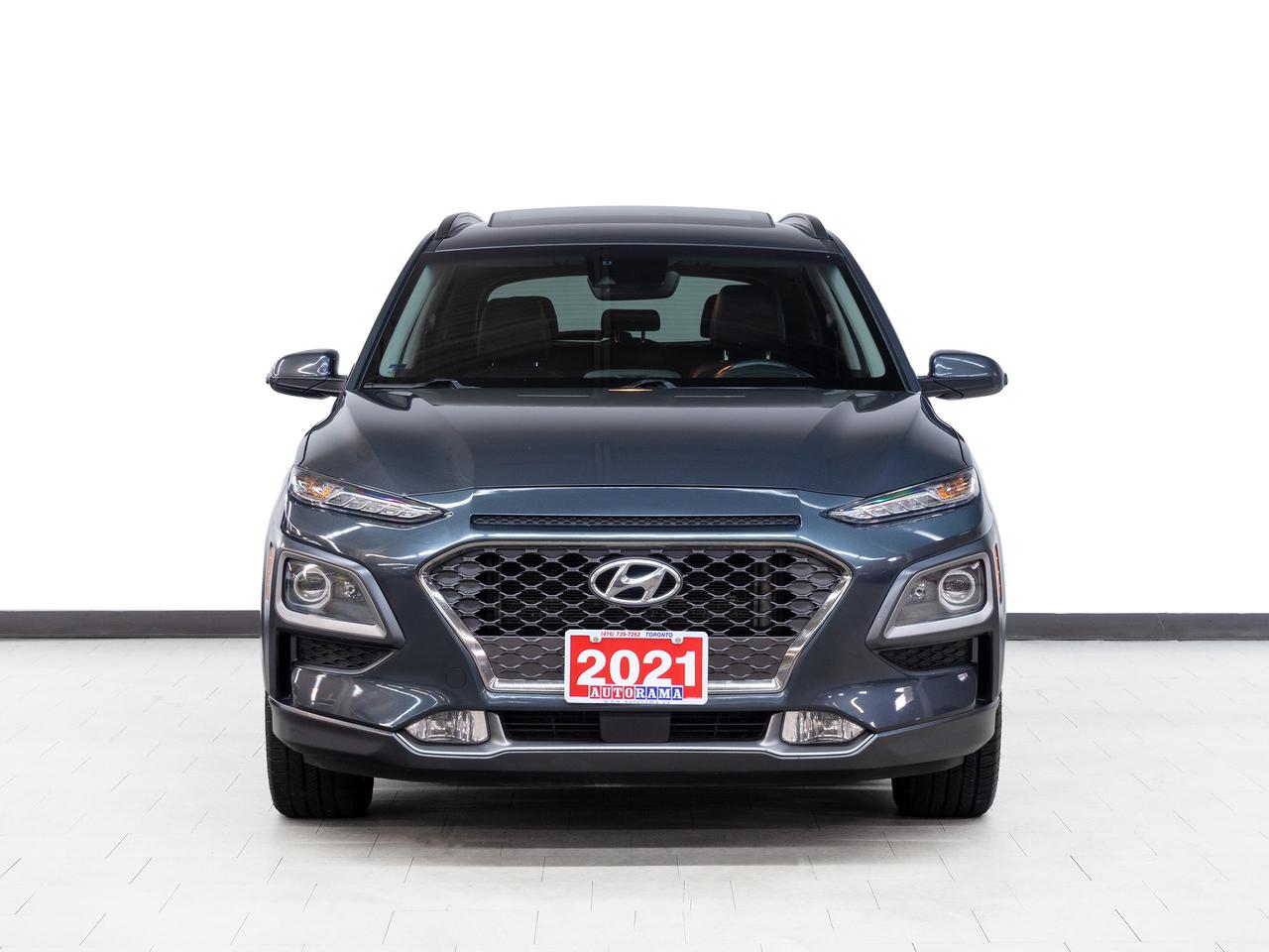 2021 Hyundai KONA ULTIMATE | AWD | Nav | Leather | Sunroof | CarPlay